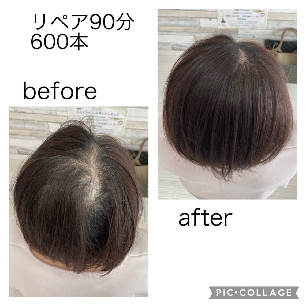 秋田店 アデランス フォンテーヌ ヘアプラス 増毛エクステ - ekmkeger.hu