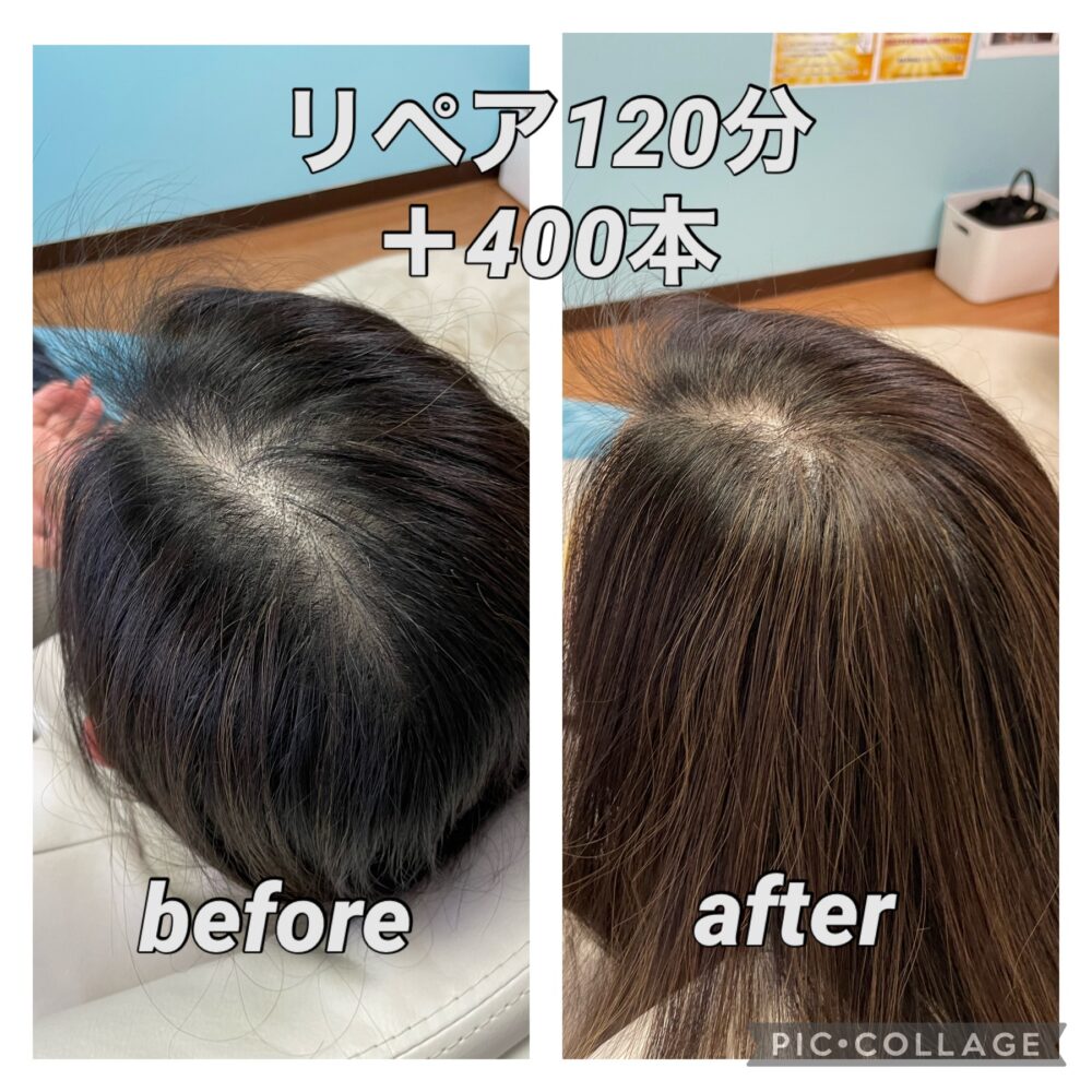 お値下げ中❗️フォンテーヌ　ヘアプラス　増毛