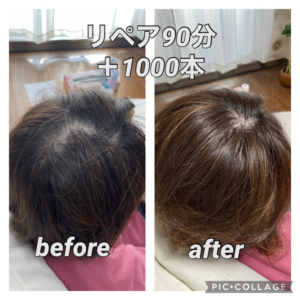 フォンテーヌ ヘアプラス 増毛エクステ 話題の人気 bdf.ir