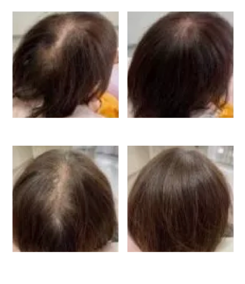 Before After